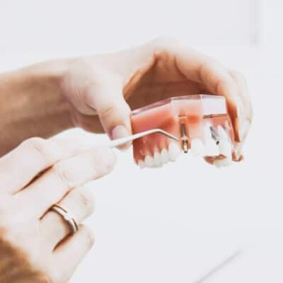 Specialist oral surgery